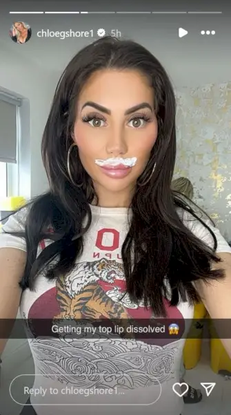 Geordie Shoren Chloe Ferryn huultentäyte on liuennut – kaksi viikkoa rintojen pienennysleikkauksen jälkeen