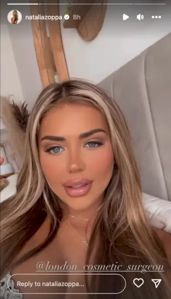 Love Islandin Natalia Zoppa avasi täytteiden saamisesta lantioonsa