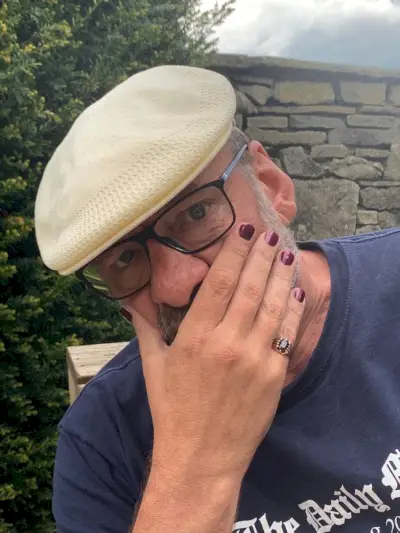 Nick on myös ollut järkyttynyt Yorkshire Dalesin ympärillä olevista paikallisista ongelmista