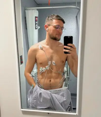 Social media influencer och Youtuber Casey Barker drabbades av en allvarlig hjärtattack förra året vid 27 års ålder